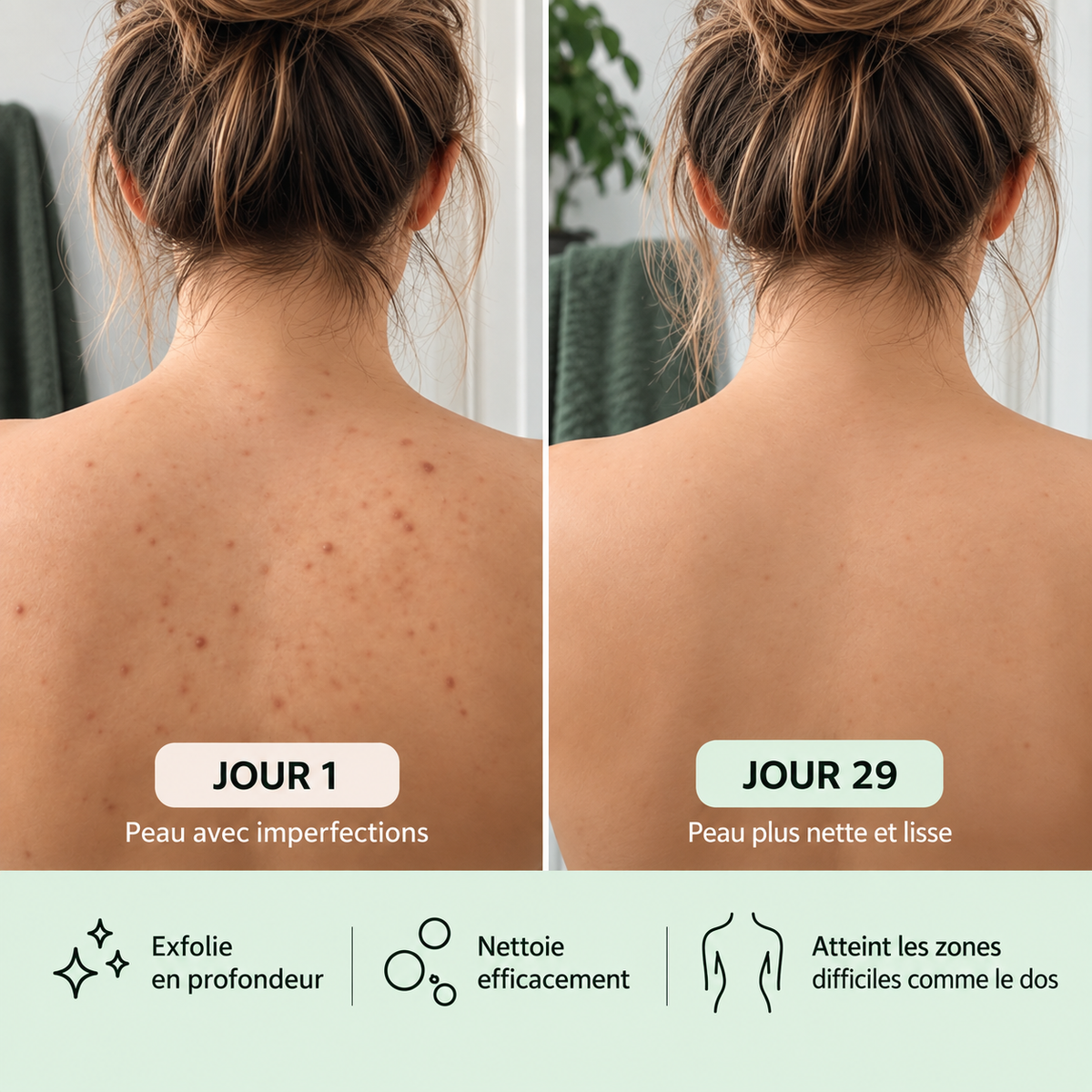 Comparaison du dos d’une femme entre le jour 1, avec des imperfections visibles, et le jour 29, avec une peau d’apparence plus nette et plus lisse.